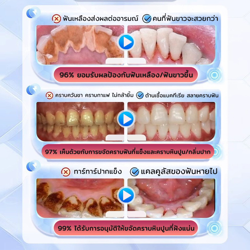 ฟอกฟันขาว-ยาสีฟันฟันขาว120g-ขจัดคราบเหลือง-ขจัดฟันเหลือง-ขจัดคราบหินปูน-ยาสีฟันฟอกฟันขาว-ยาสีฟันขจัดคราบหินปูน