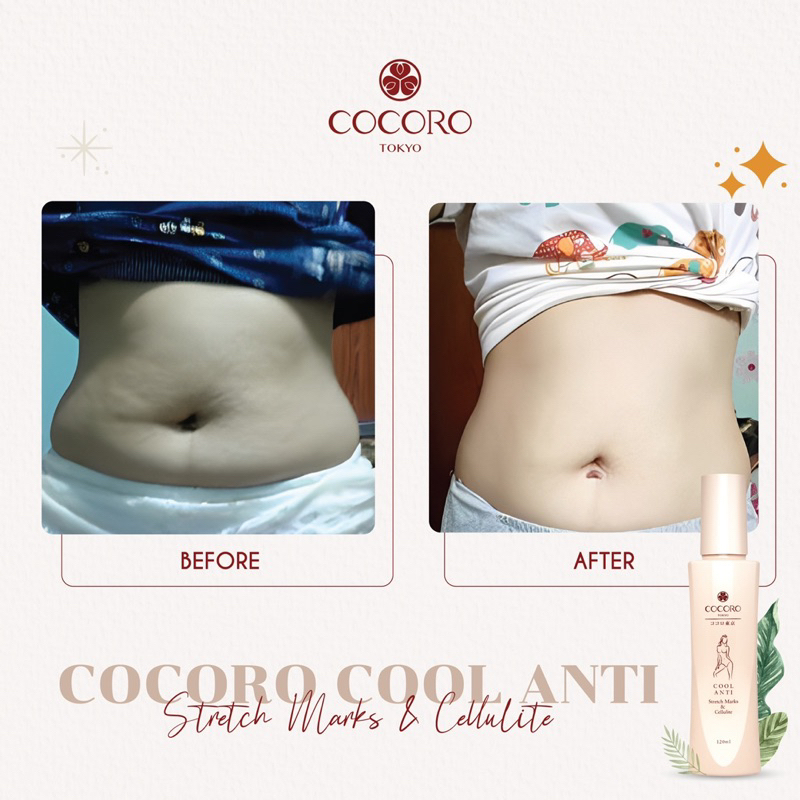 cocoro-tokyo-cool-anti-stretch-marks-amp-cellulite-120ml-ลดรอยแตกลายสีเข้ม-บำรุงหลังคลอด-ลดเซลลูไลท์-ผิวบวมน้ำ