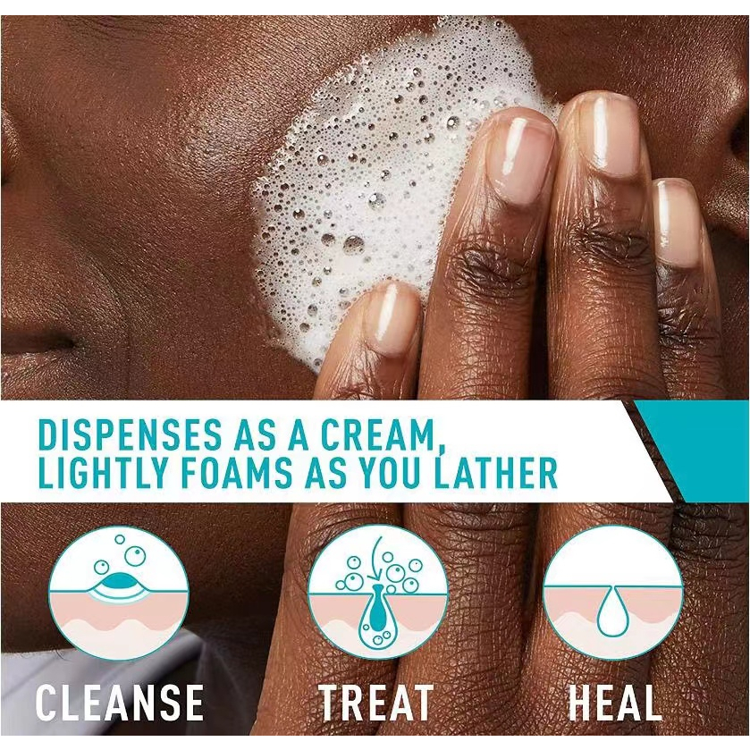 พร้อมส่ง-cerave-acne-foaming-cream-cleanser-benzoyl-peroxide-acne-treatment-150-ml