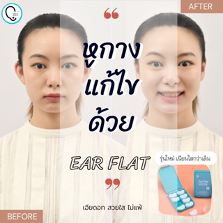 พร้อมส่งจากไทย แก้ปัญหาหูกางด้วย Ear flat ปรับปรุงใหม่เนียนใส/บางกว่าเดิม ใช้คู่กับกาวรียูส(ตัวแทนจำหน่ายในไทย)_OP017