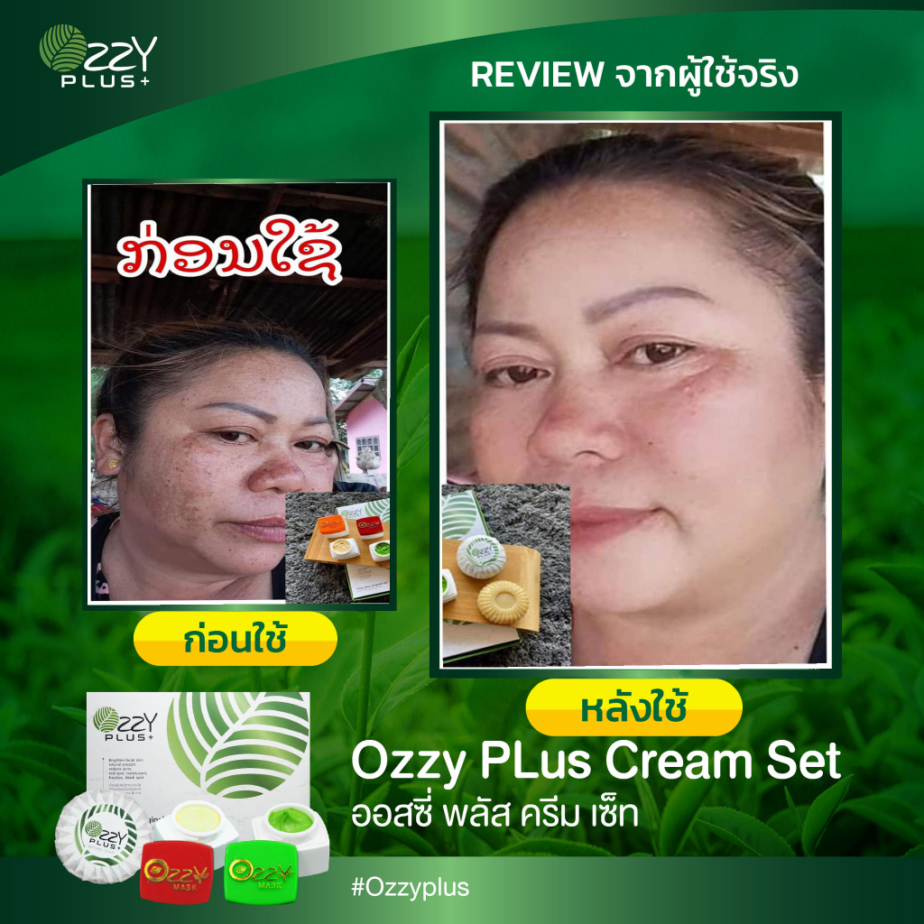 ครีมออสซี่พลัส-ozzyplus-แถม-คลอลาเจน-1-กระปุก-ครีมชาเขียว-ลดสิวฝ้า-กระ-จุดด่างดำ-หน้าใส-ขนาด-50กรัม