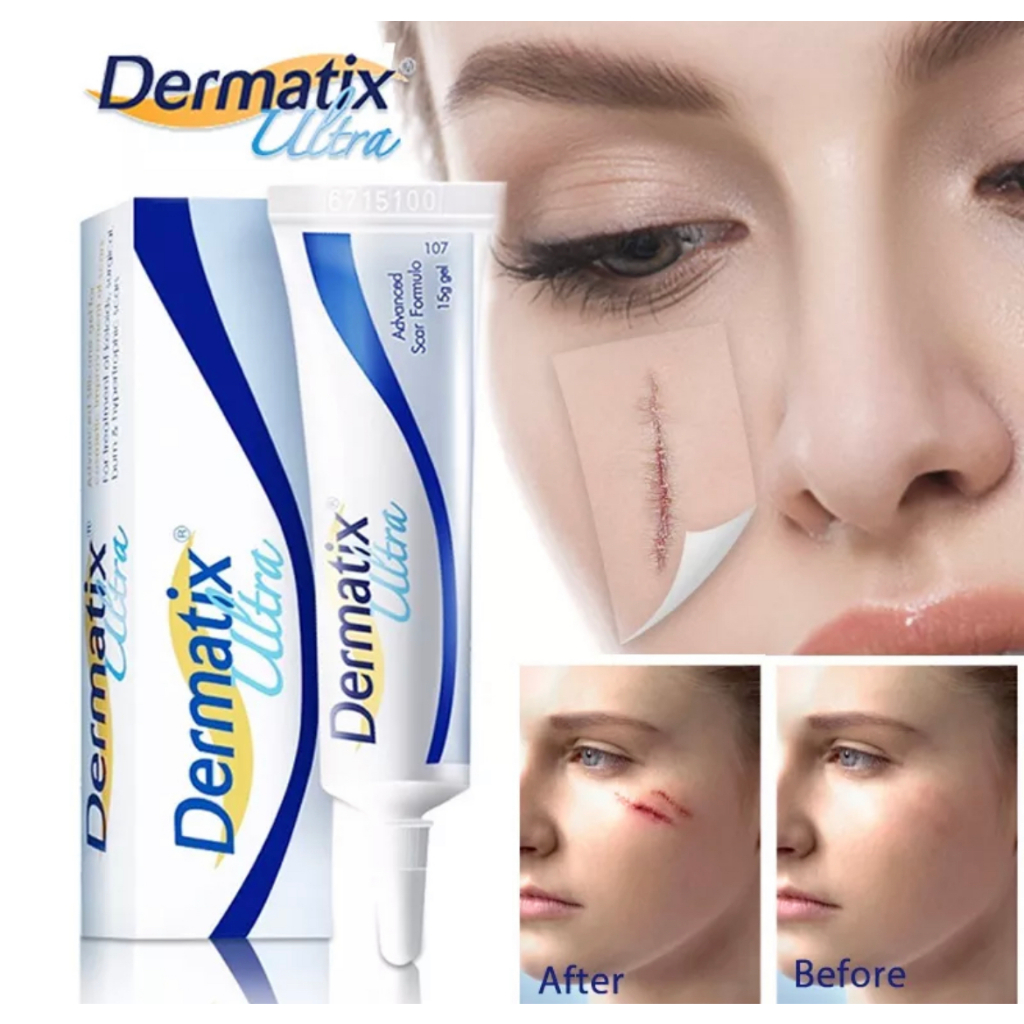 พร้อมส่งจากไทย-dermatix15g-ของ-แท้-100-นำเข้า-จาก-usa-ครีมลดรอยแผลเป็น-ซ่อมแซมรอยแผลเป็นจากการผ่าตัด-เจลลบรอยแผลเป็