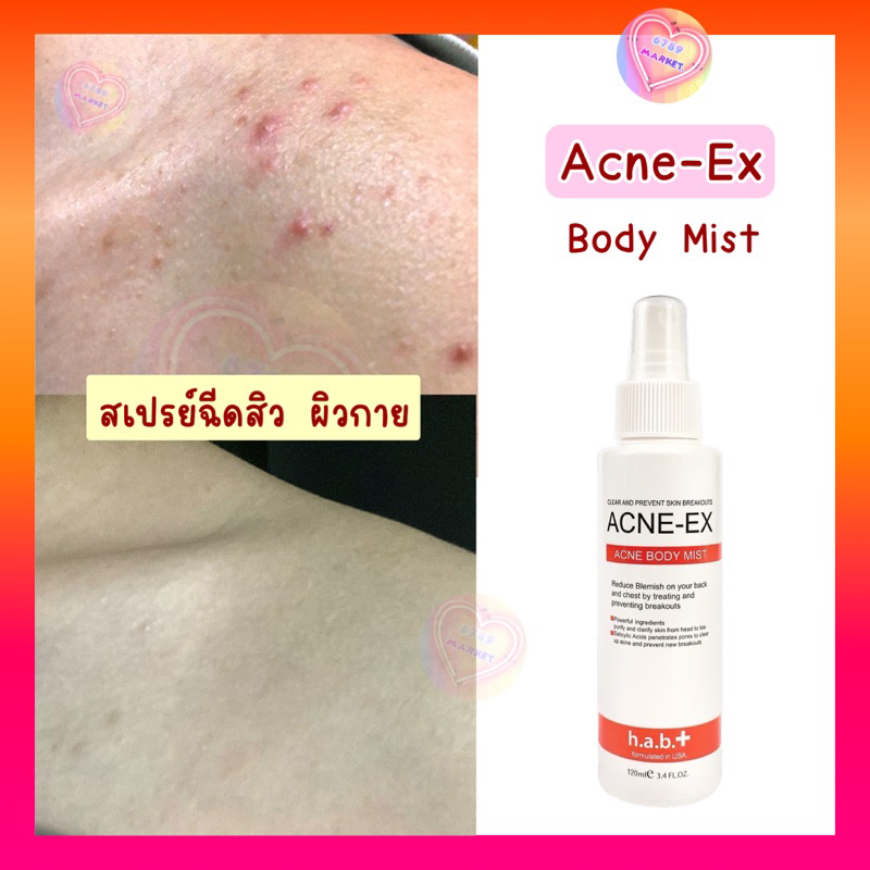 สเปรย์ฉีดสิว-ใช้ดี-รีวิวเพียบ-ของเเท้-acne-ex-body-spray-120-ml-mk008-acne-ex