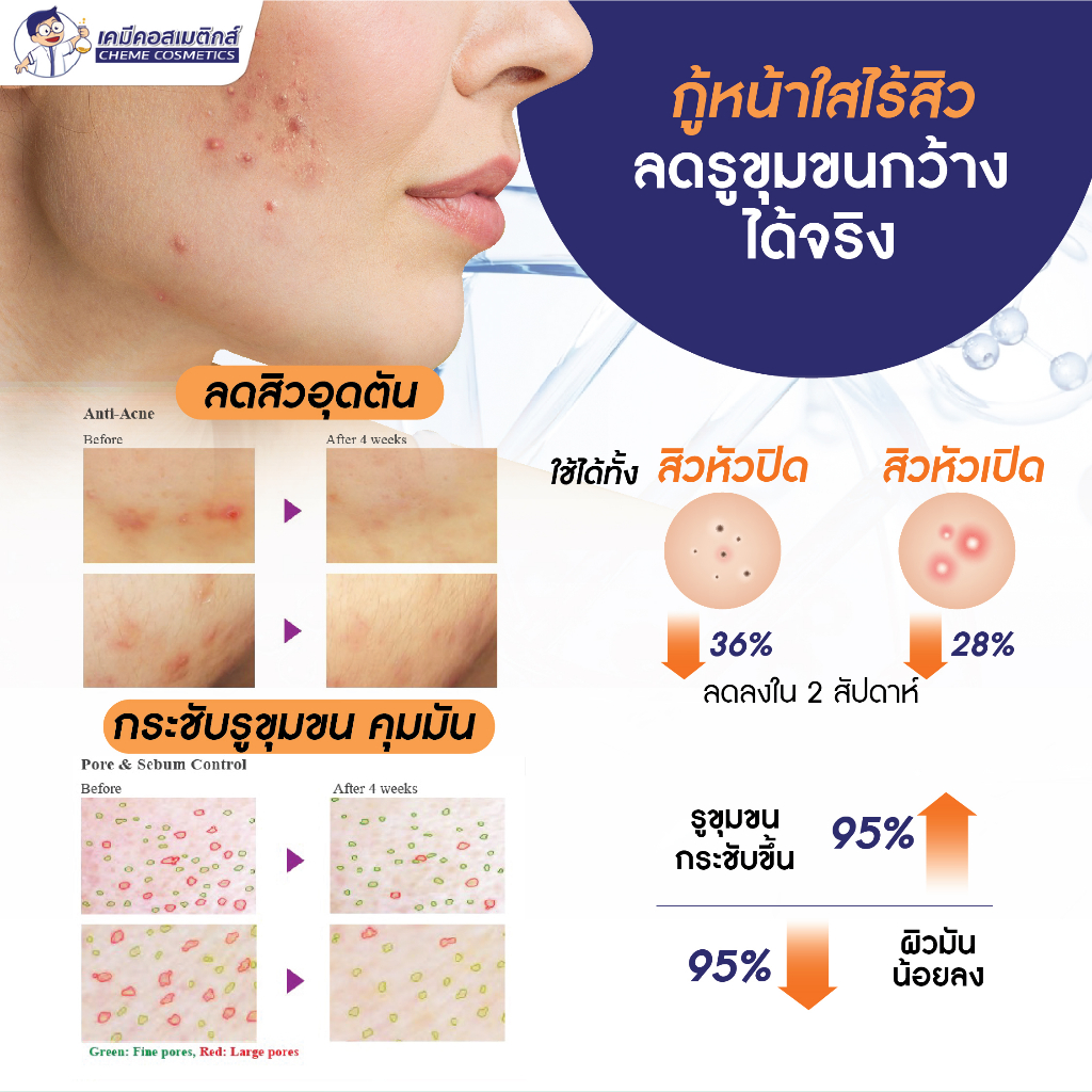 cg-ptx-เปปไทด์-botulinum-toxin-type-c-ตัวแรกของโลกที่พัฒนาโดยเทคโนโลยีแพลตฟอร์มเปปไทด์พร้อมระบบนำส่งเข้าสู่ผิว