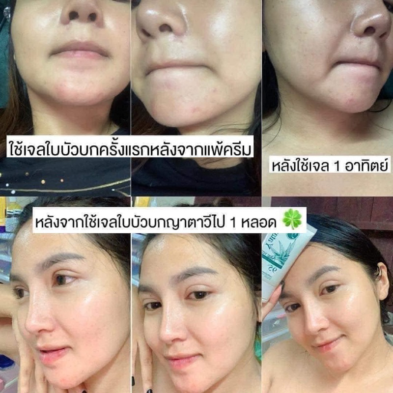 เจลใบบัวบก-ญาตาวี-ลดสิว