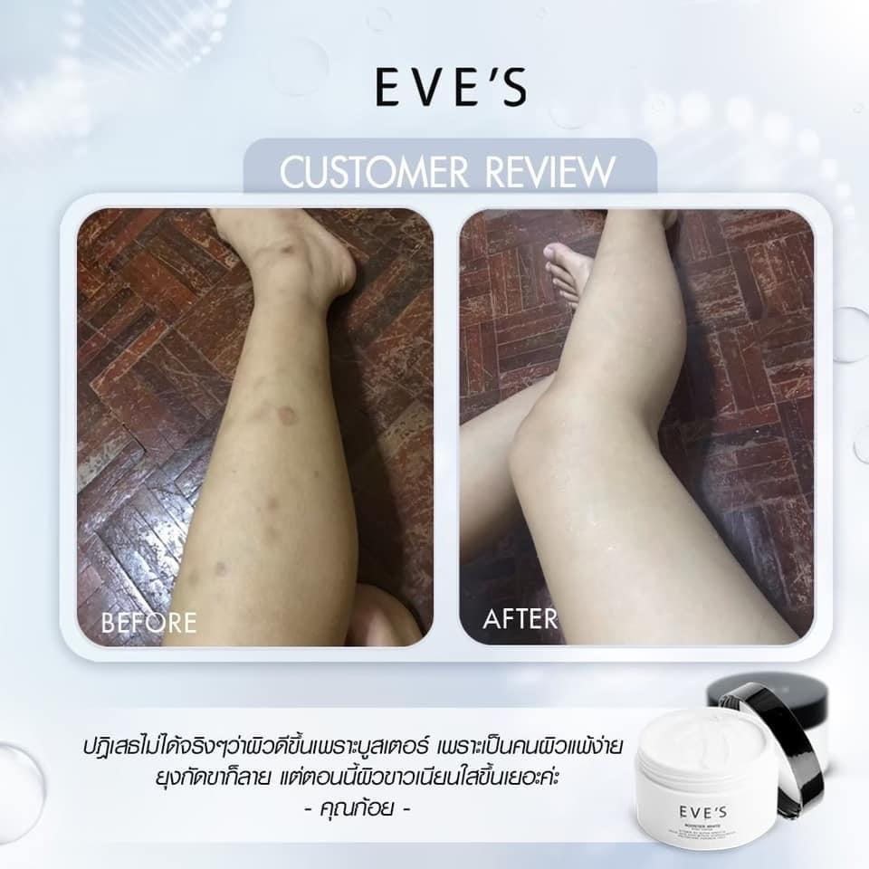 eves-บูสเตอร์-ผิวขาวกระจ่างใส-ลดเลือนจุดด่างดำ-และผิวแตกลาย-booster-white-body-cream