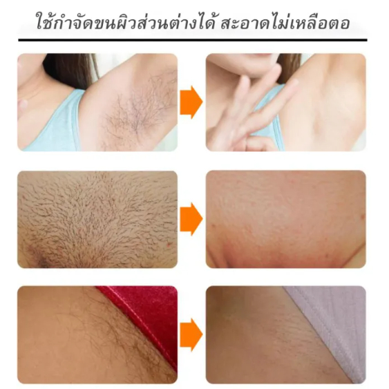 สเปรย์กำจัดขน-ครีมกําจัดขนน้องสาว-มูสกําจัดขน-150ml-กำจัดขนรักแร้-กำจัดขนขา-ขจัดขนได้ง่ายและไม่เจ็บ-ไม่ระคายเคืองผิว