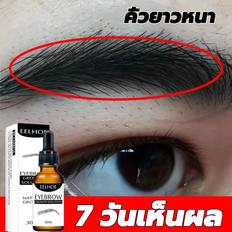 eelhoe-เซรั่ม-ปลูก-คิ้ว-น้ำยาปลูกหนวด-คิ้วดก-หนวดดก-คิ้วเข้ม-30ml-เซรั่มคิ้วดก-เซรั่มปลูกคิ้ว-ยาปลูกคิ้ว-น้ํายาปลูกคิ้ว