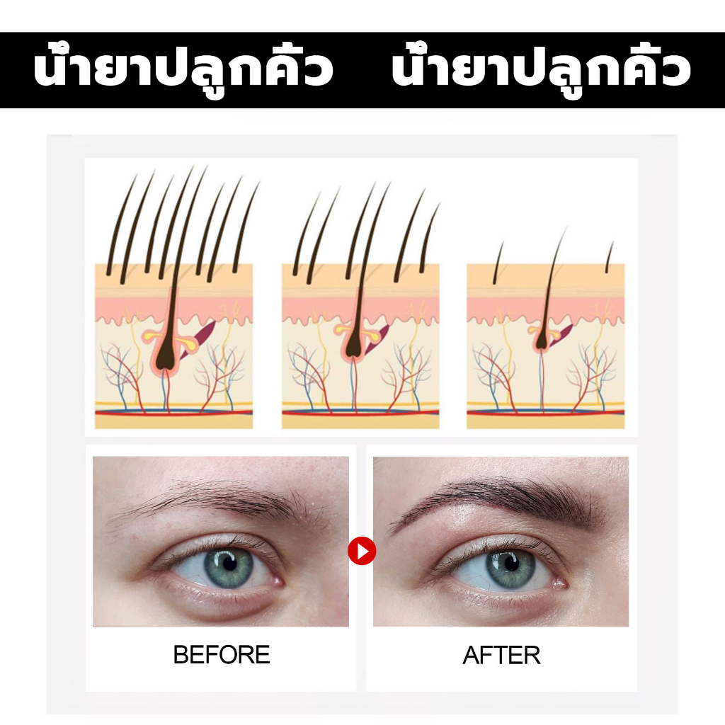 eelhoe-เซรั่ม-ปลูก-คิ้ว-น้ำยาปลูกหนวด-คิ้วดก-หนวดดก-คิ้วเข้ม-30ml-เซรั่มคิ้วดก-เซรั่มปลูกคิ้ว-ยาปลูกคิ้ว-น้ํายาปลูกคิ้ว