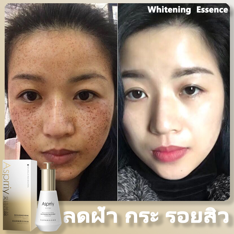 เซรั่มบำรุงผิวหน้า-เซรั่มหน้าขาวใส-35ml-จุดด่างดำจางเร็ว-หน้าขาวใส-ลดริ้วรอย-กระชับรูขุมขน-ครีมทาฝ้ากระ-ครีมแต้ม