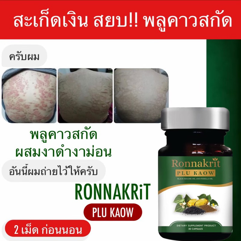 ซื้อ2แถม1-อาหารเสริมแก้สะเก็ดเงิน-ronnakrit-พลูคาว-สกัด