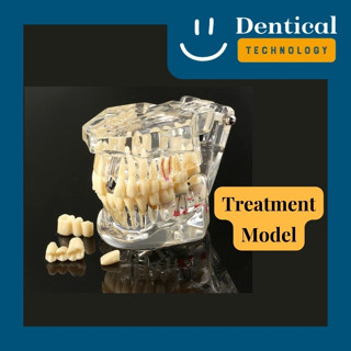 โมเดลการรักษาทางทันตกรรมหลากหลายแบบ (Treatment Model)