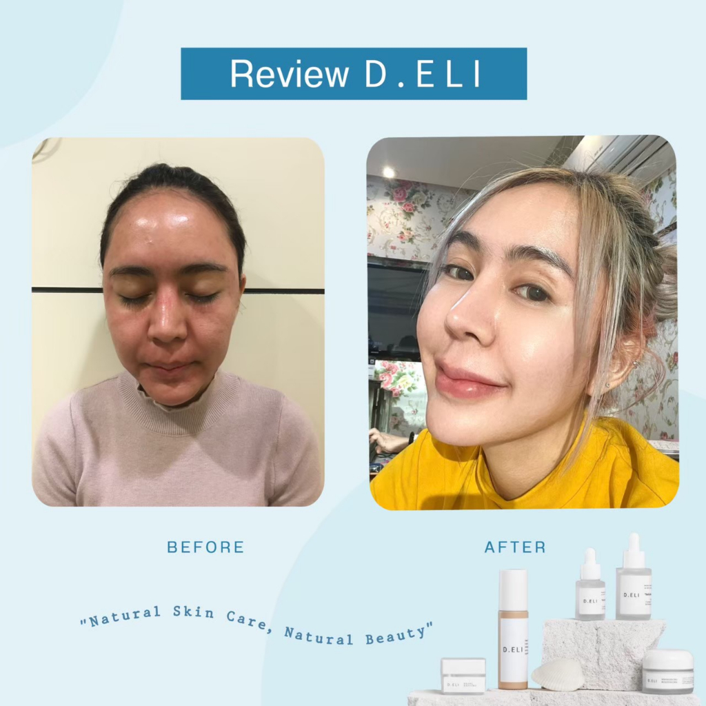 ครีมไข่มุก-d-eli-pearl-repair-ยับยั้งการเกิดสิว-ลดรอยแดง-รอยดำ-ปรับผิวเนียนกระจ่างใส-เห็นผล-7-วัน