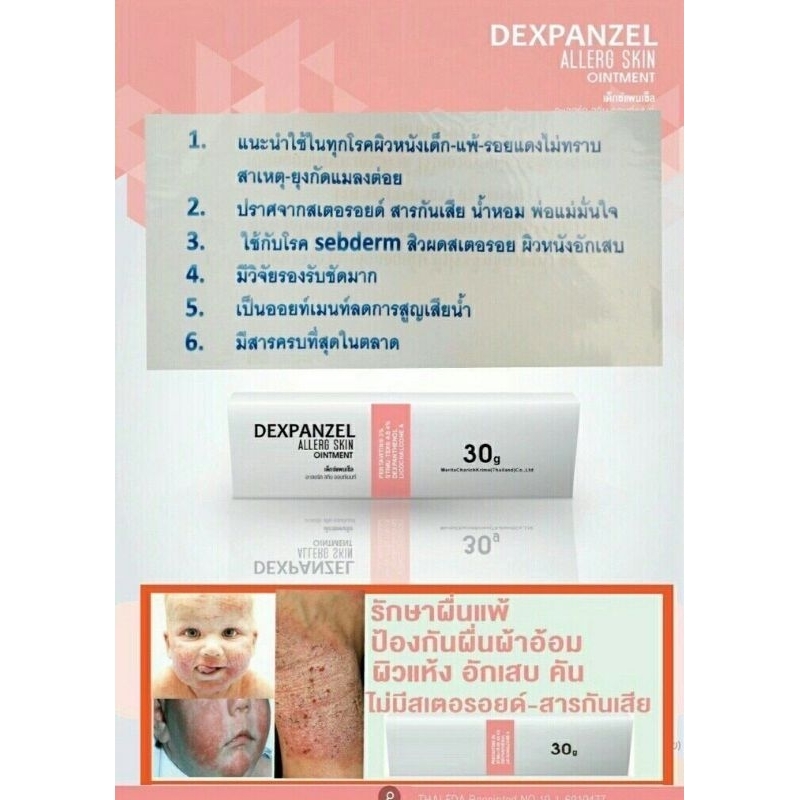 dexpanzel-allergy-skin-ointment-รักษาผื่นแพ้คัน-ผิวหนังอักเสบ