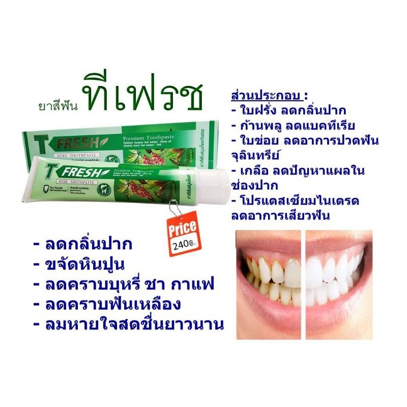 ยาสีฟันสมุนไพร-ที-เฟรส-t-fresh-200กรัมส่วนผสมใบข่อย-ใบฝรั่ง-กานพลู