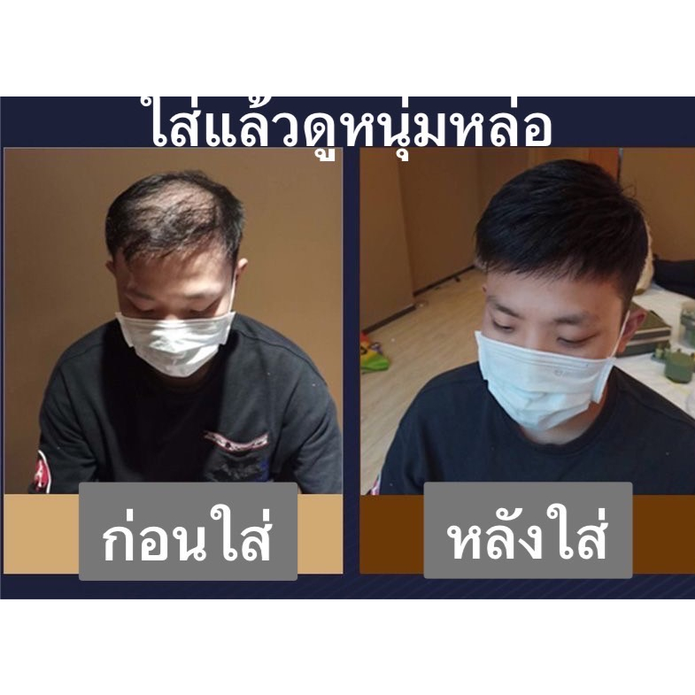 วิกผมปิดผมบาง-ผมแท้ปิดผมบางชาย-ผมแท้100-ปิดผมบาง-ติดกิ๊ฟได้ติดกาวได้