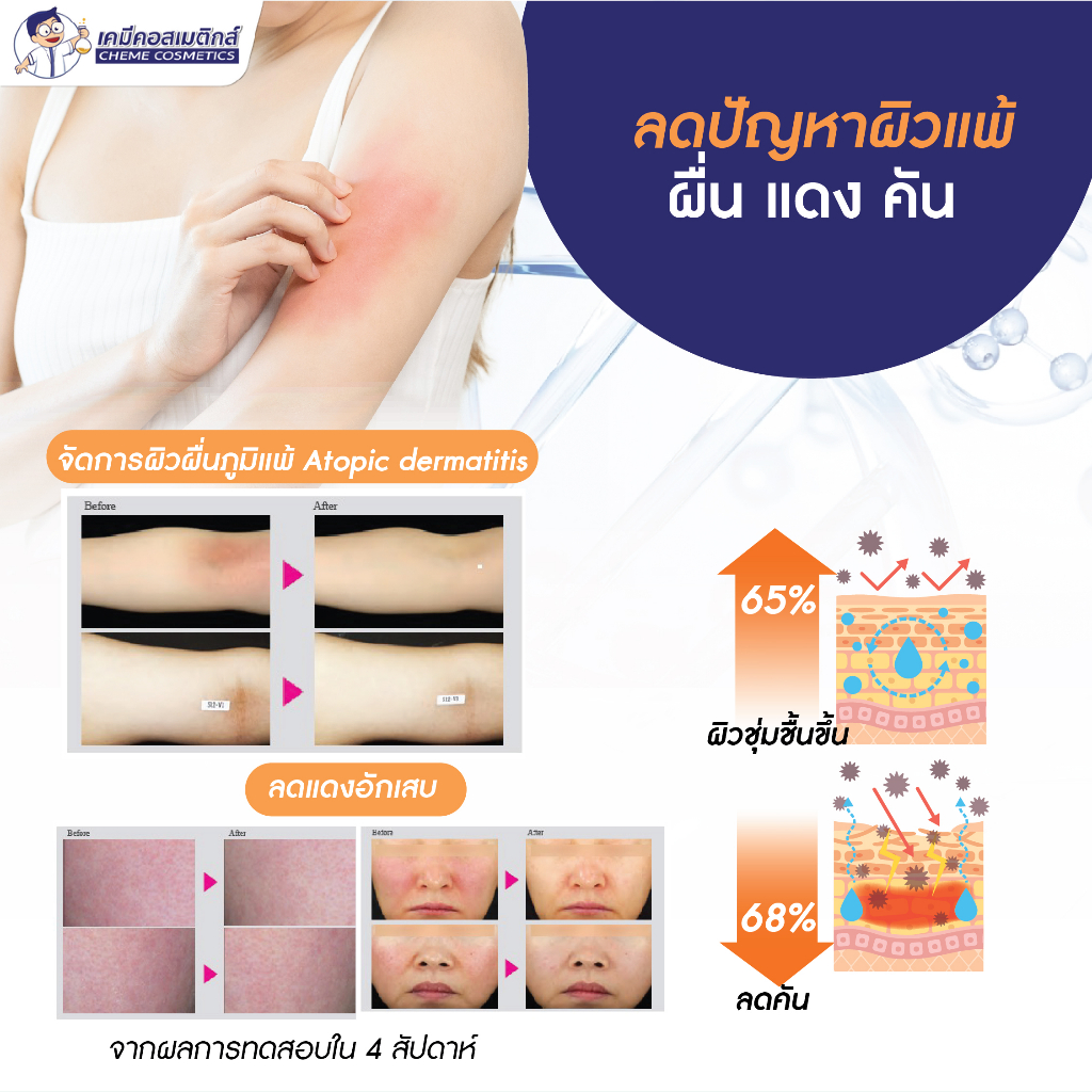 cg-ptx-เปปไทด์-botulinum-toxin-type-c-ตัวแรกของโลกที่พัฒนาโดยเทคโนโลยีแพลตฟอร์มเปปไทด์พร้อมระบบนำส่งเข้าสู่ผิว