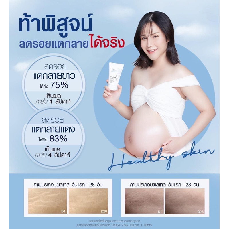 eves-stretch-mark-body-oil-gel-อีฟส์ออยล์-ลดเลือนรอยแตกลาย-บำรุงผิวเนียนนุ่ม-คืนความ-ชุ่มชื้นให้ผิว