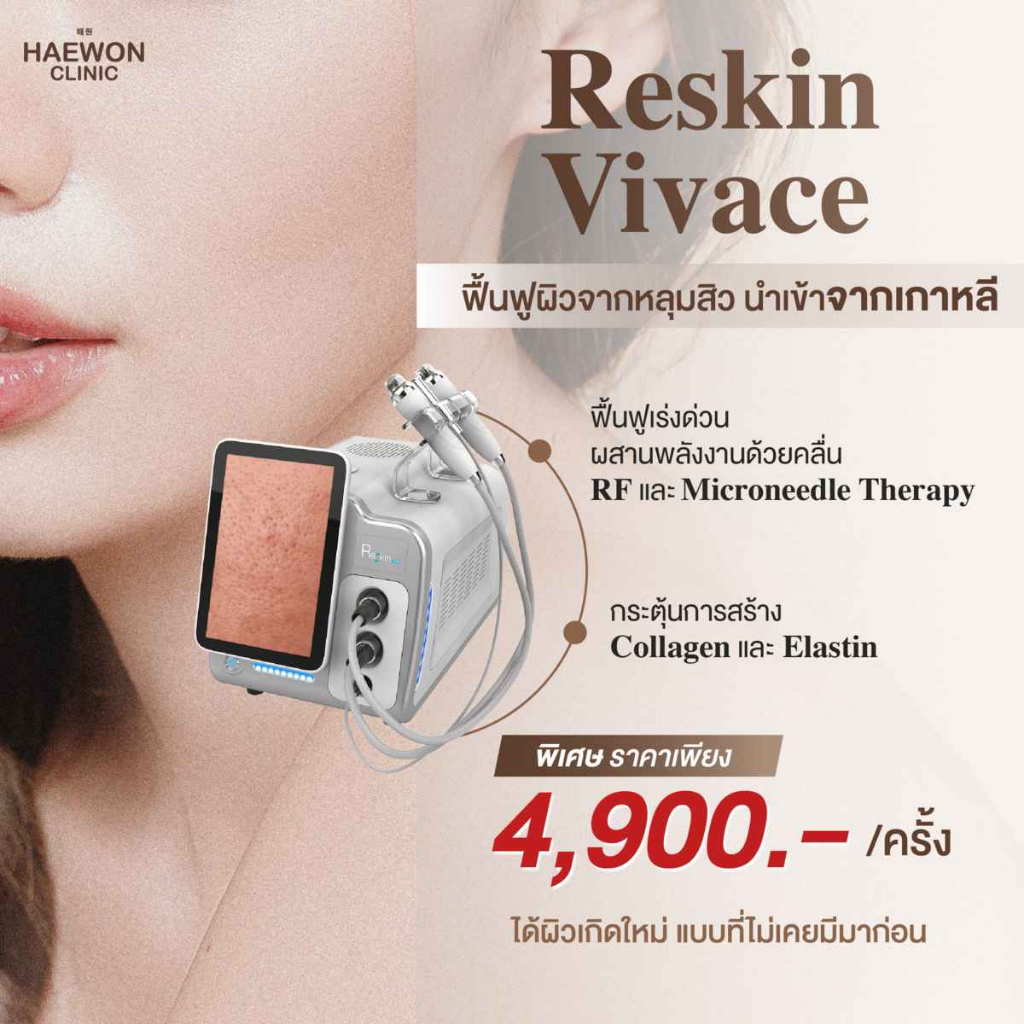 Vivace Reskin กู้ผิวจากหลุมสิว เปลี่ยนหน้ารูให้เรียบเนียน ยกกระชับผิวx3 ...