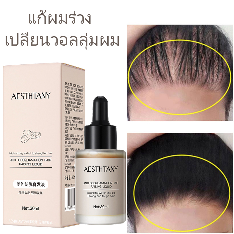 เซรั่มปลูกผม-น้ำยาเร่งผมยาว-เซรั่มขิง-ปลูกผม-30ml-น้ำยาปลูกผม-เซรั่มปลูกผม-ป้องกันผมร่วง-บอกลางความบาง-บำรุงผม-ผมดกกำ