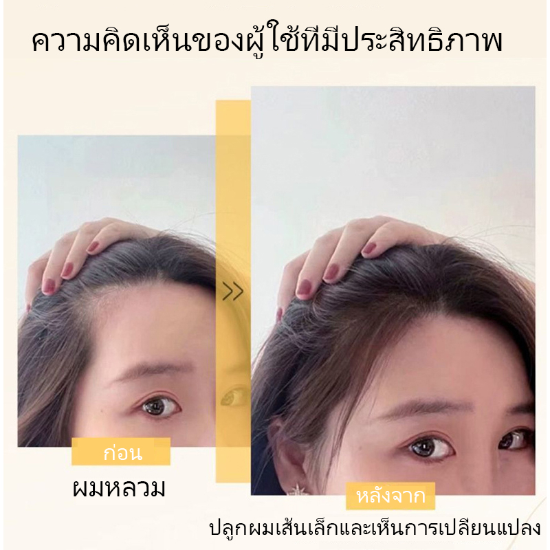 เซรั่มปลูกผม-น้ำยาเร่งผมยาว-เซรั่มขิง-ปลูกผม-30ml-น้ำยาปลูกผม-เซรั่มปลูกผม-ป้องกันผมร่วง-บอกลางความบาง-บำรุงผม-ผมดกกำ