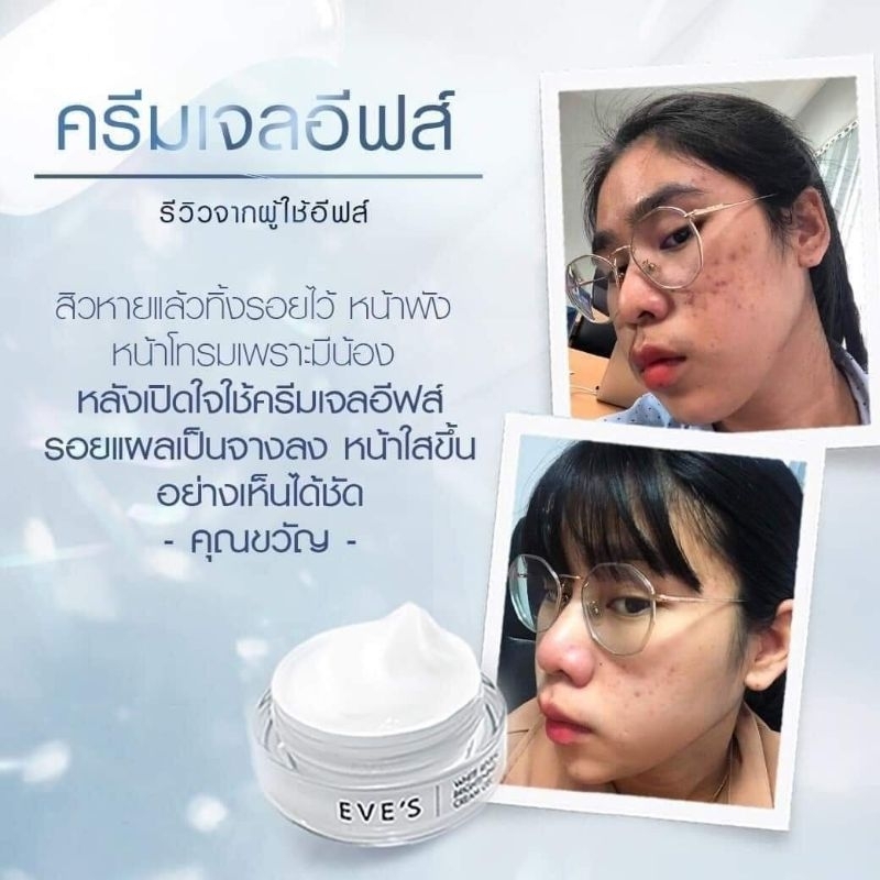 เซ็ตหน้าใส-เรียบเนียน-eves-cream-gel-eves-hyaluron-serum-กระชับรูขุมขน-ผิวเด้ง-ผิวอิ่มฟู-ลดรอยสิว-ลดฝ้ากระ-จุดด่างดำ