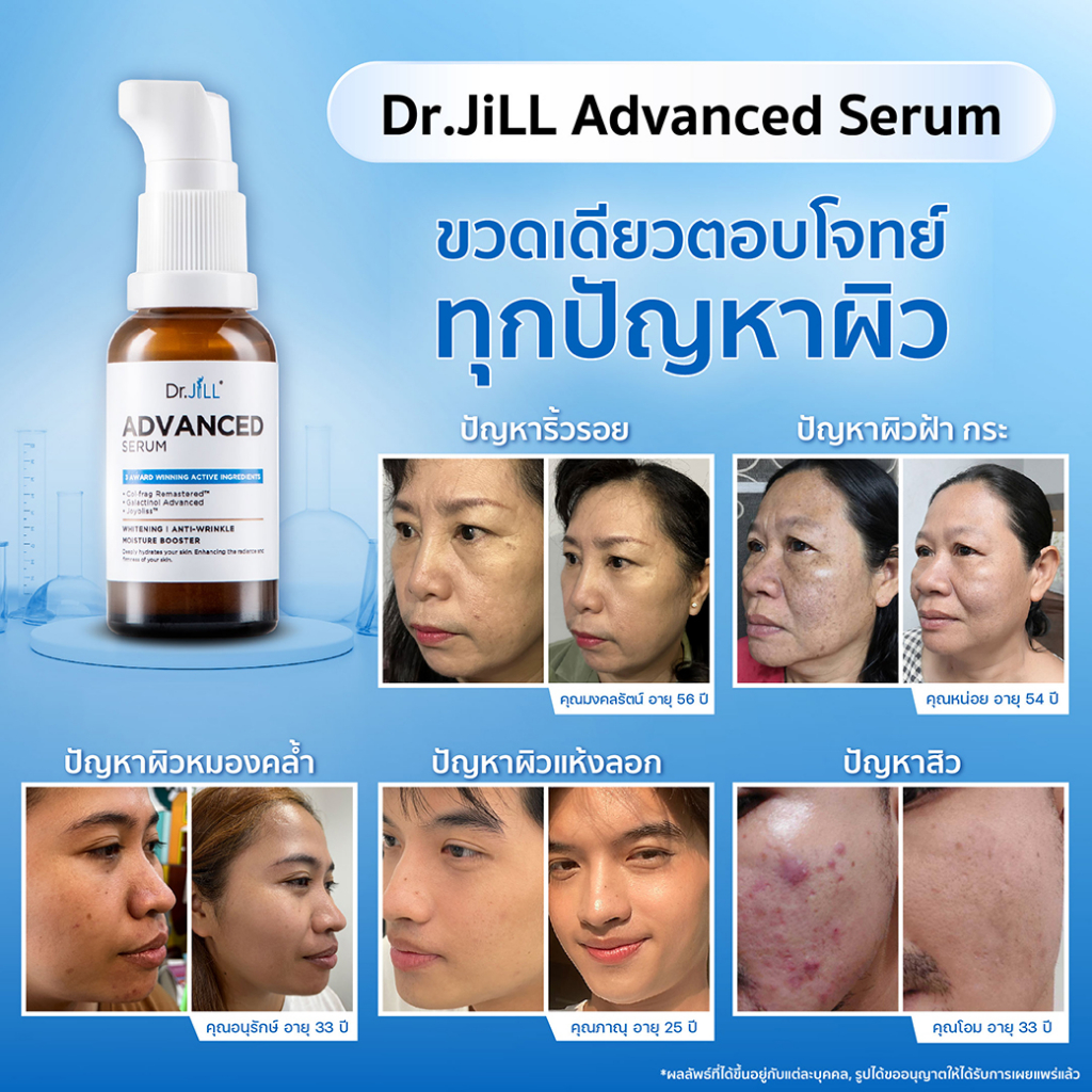 ส่งฟรี-เซตกันหมอง-4-ชิ้น-dr-jill-advanced-serum-ดร-จิล-สูตรใหม่-กันฝ้า-กันแก่-สำหรับแห้ง-แพ้ง่าย