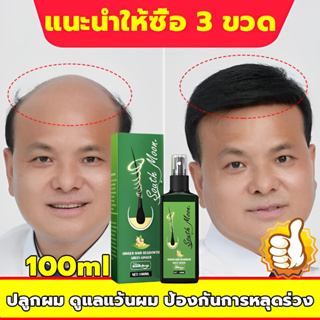 【แก้ปัญหาหัวล้าน】เซรั่มปลูกผม 100ml น้ำยาเร่งผมยาว ป้องกันผมร่วง สเปรย์ปลูกผม นีโอแฮร์ของแท้ น้ำยาปลูกผมด เร่งผมยาว