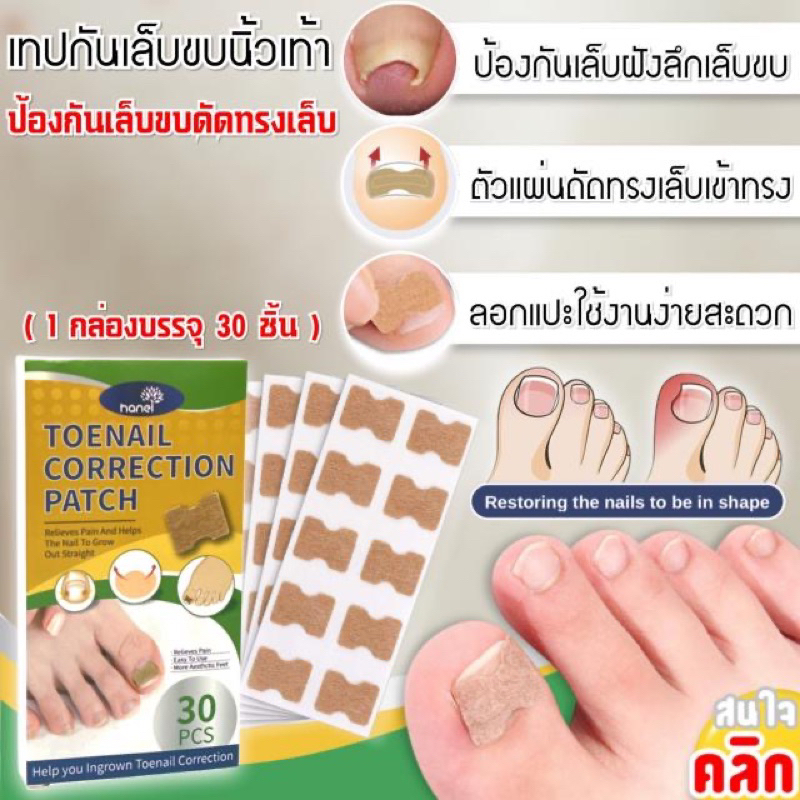 เทปแปะเล็บขบ-แก้ปวดเล็บขบ