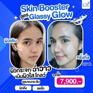 [E-Voucher] Skin Booster สูตร Glassy Glow by Charmer Clinic