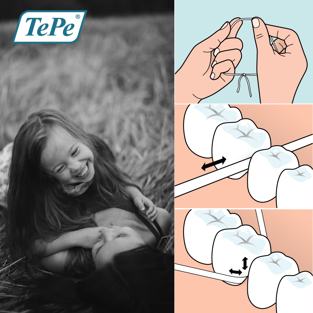 tepe-dental-tape-ไหมขัดฟัน-ชนิดเทป-เทเป้-เด็นทัล-เทป-by-dennex