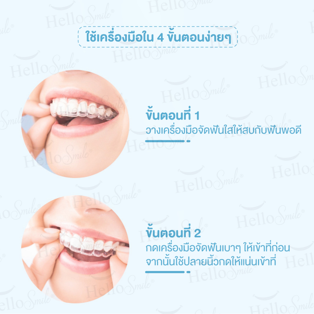 รุ่น-candy-hellosmile-ชิววี่-ยางกัดจัดฟัน-ยางกัดฟัน-สำหรับคนจัดฟันใส-invisalign-aligner-chewies-จัดฟันใส-ยางกัดฟัน