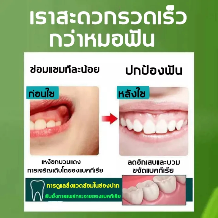 จัดส่งทันที-จัดส่งที่รวดเร็ว-ยาพ่นแก้ปวดฟัน-bescare-สารสกัดสมุนไพรจีน-พบหมอฟันสิบครั้ง-ฉีดครั้งเดียวดีกว่า-สูตรธรรมชาติ