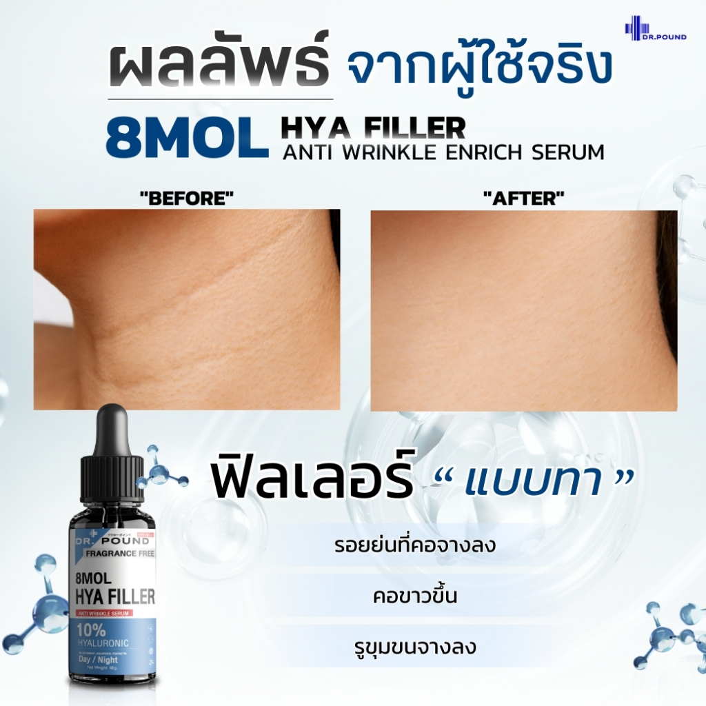 dr-pound-8mol-hya-filler-anti-wrinkle-enrich-seru-10-hya-filler-ฟิลเลอร์แบบทา-ไฮย่าหมอปอนด์-ฟิลเลอร์หมอปอนด์-ผิวอิ่มฟู