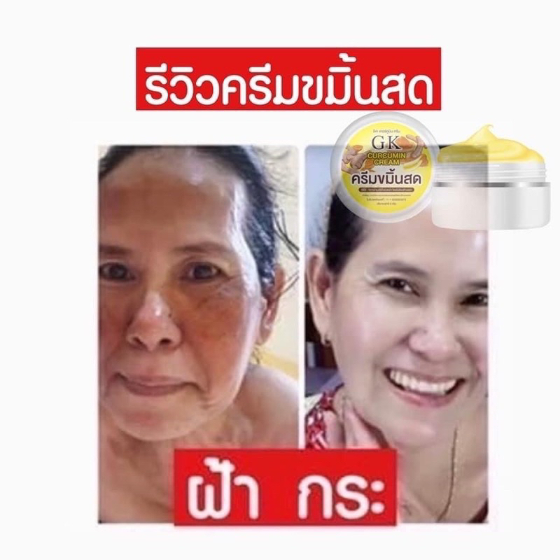 ของเเท้-ครีมขมิ้นสดgk-เซ็ต6ชิ้น-สุดคุ้ม