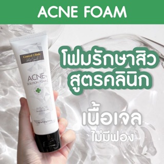 Acne Solution Foam แอคเน่ โซลูชั่น โฟม โฟมล้างหน้าสูตรเจลสำหรับคนมีสิว ผิวแพ้ง่าย คุณแม่ตั้งครรภ์ใช้ได้