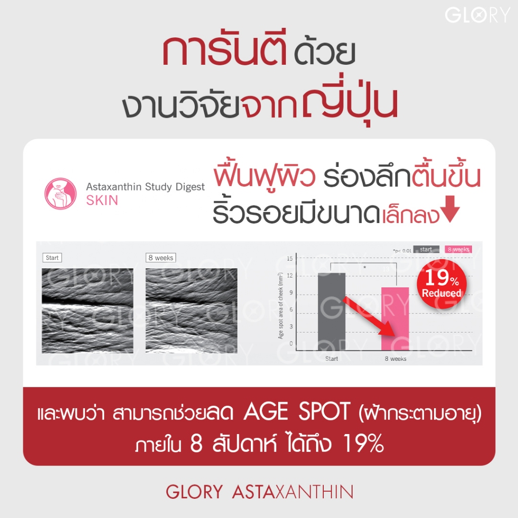 GLORY Astaxanthin แอสต้าแซนธิน 6 mg แคปซูล Capsules Astareal + Grape Skin Extract + Co Q10 + Vit E วิตามินผิวเด็ก สารสกัดจาก สาหร่ายสีแดง สาหร่ายฮีมาโตค็อกคัส พลูวิเอลิส