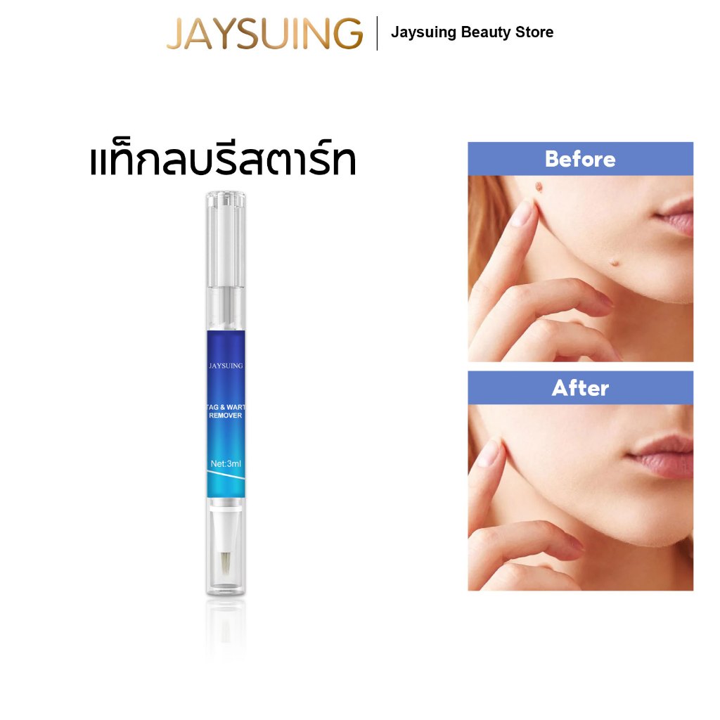 Jaysuing ติ่งเนื้อ หูดกรัมเพื่อลบปากกาดูแลไ 1Pcs ฝเพื่อลบหูดแบนแบนหูด ...
