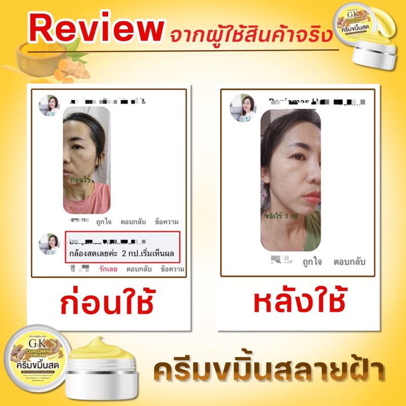 ของแท้-ครีมขมิ้นสดgk-ครีมขมิ้น6กระปุก-สุดคุ้ม