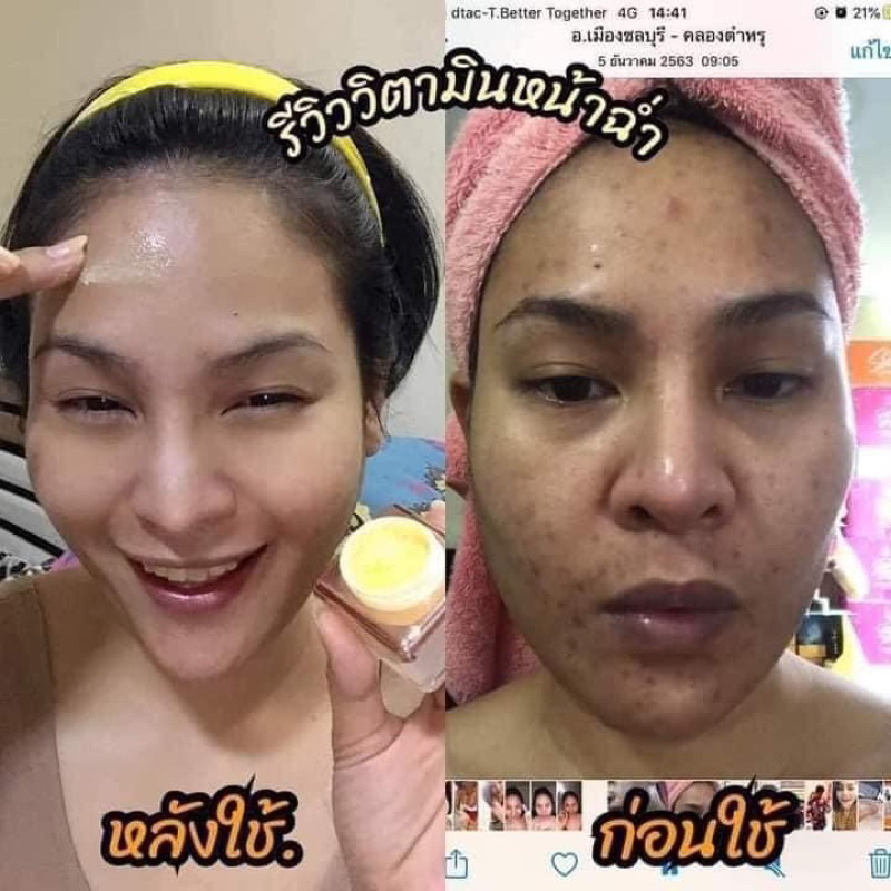 วิตามินหน้าใส-มีของแถมทุกกล่อง-ฟื้นฟูผิวให้ขาวกระจ่างใส-ของแท้-100