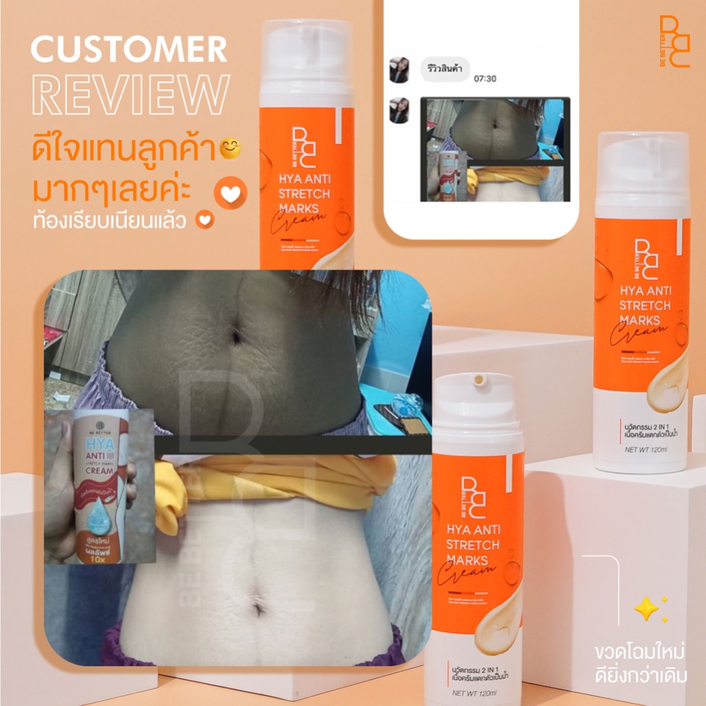 ครีมลดรอยแตกลาย-be-better-1ขวด-น้ำตบสยบรอยแตก-ครีมขาลาย-ก้นลาย-ครีมแก้ท้องลาย