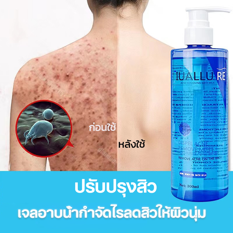 สบู่ลดสิว-ครีมอาบน้ำ-สบู่ไวท์เทนนิ่ง-300ml-ครีมอาบน้ําโฟมเยอะ-รักษาสิว-สบู่ลดสิวที่หลัง-เจลอาบน้ำ-ผิวขาว-ลอกสิวเสี้ยน