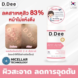 [มูสล้างหน้าลดสิว] D.Dee ทำความสะอาดล้ำลึกด้วยเทคโนโลยี Micellar ผิวไม่แห้งตึง ลดการอุดตัน คุมความมันบนใบหน้า ฟื้นฟูผิว