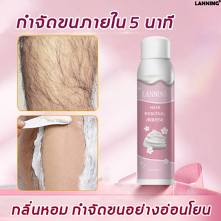 【ซื้อ 1 แถม 1】Lanning มูสกำจัดขน 150ml มูสกำจัดขนถาวร กำจัดขนขา กำจัดขนรักแร้ ขจัดขน กลิ่นหอมสดชื่น อ่อนโยนต่อผิว