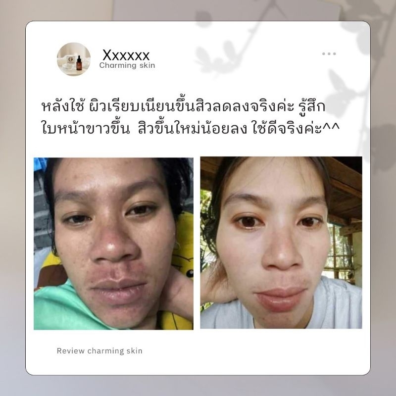 ส่งฟรี-ครีมชาร์มมิ่งสกินไนท์ครีมใหญ่-เซรั่มใหญ่-1-190-บาท