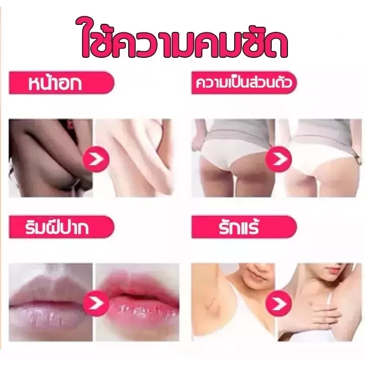 ครีมทาขาหนีบดำ-ครีมทาก้นดำ-ขาหนีบดํา-ครีมทาก้น-ครีมทาตูดดำ-ครีมทาแคมดำ-ครีมแก้ขานีบดำ-คอขาว-ก้นดํา-ดำตรงไหน-ทาตรงนั้น