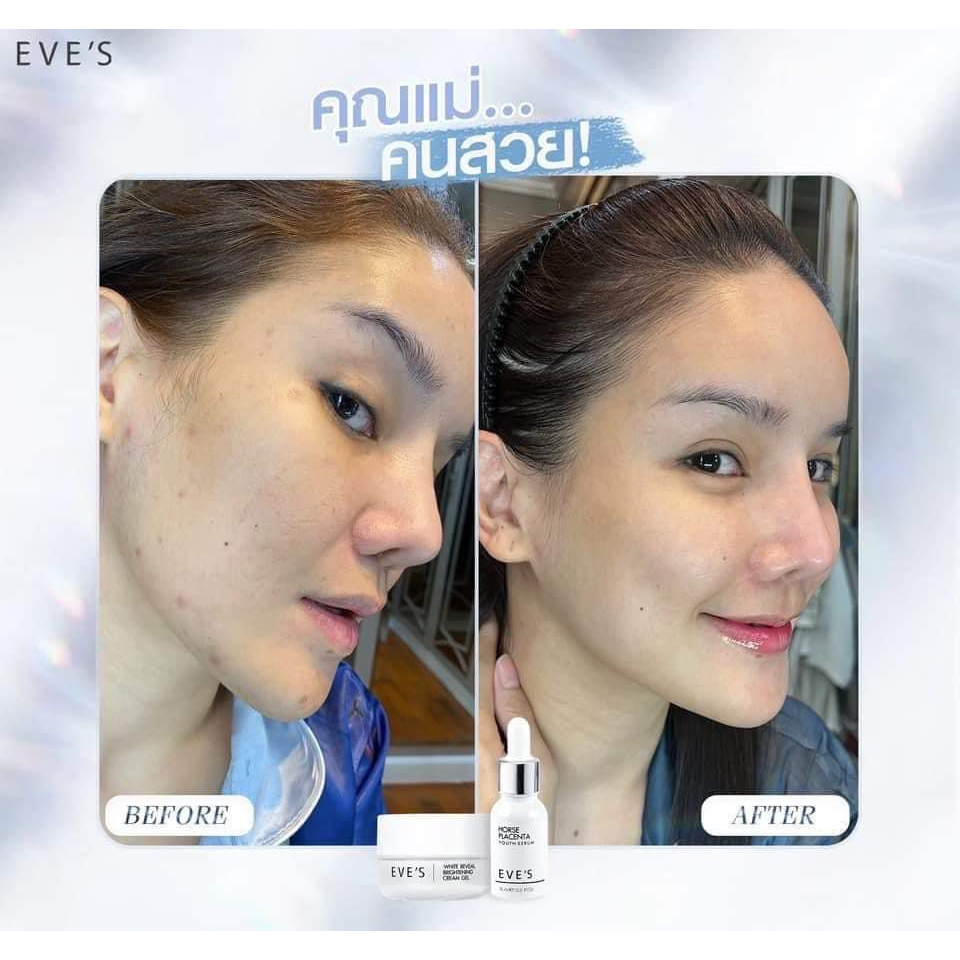 เซรั่มอีฟส์-ครีมเจลอีฟส์-เซตคู่หน้าใสx2