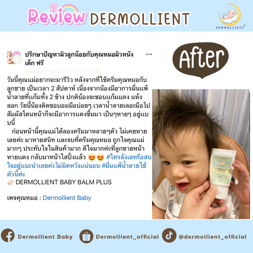 บาล์มสำหรับเด็กผิวแพ้ง่าย-25-กรัม-โดยแพทย์ผิวหนังเด็ก-dermollient-baby-balm-plus