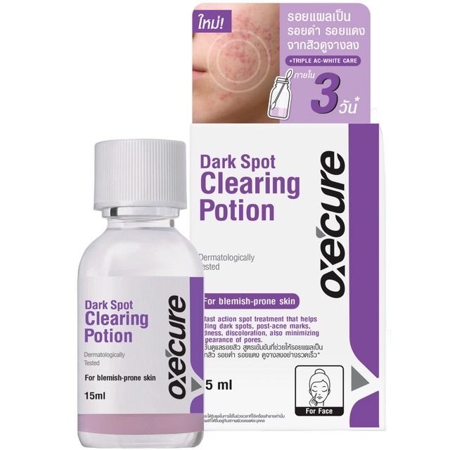 Oxe Cure Acne Clear Potion