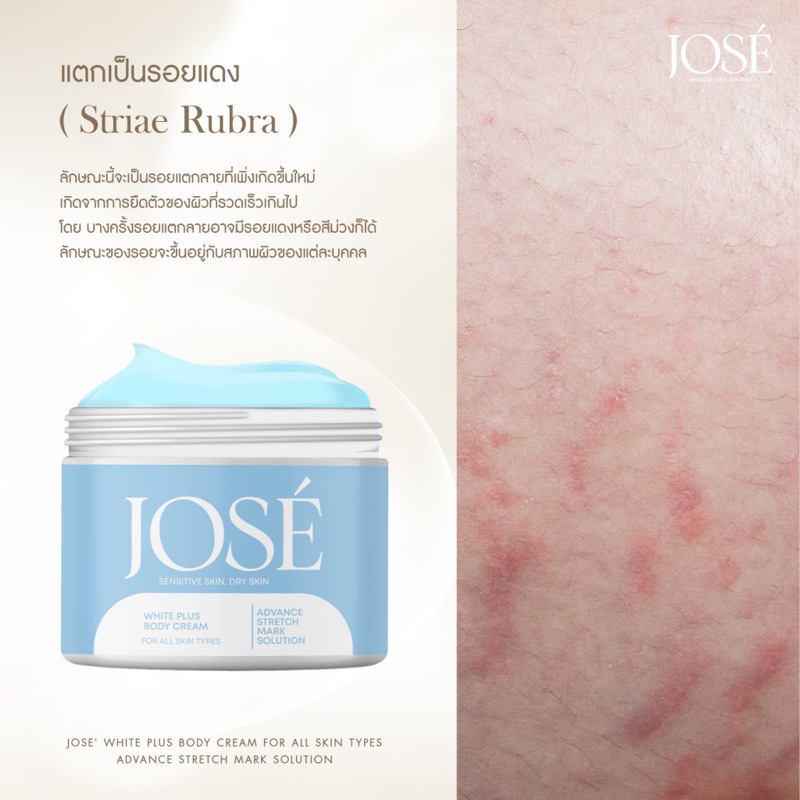 แท้💯% JOSE Body Cream ครีมโจเซ่ Jose White Plus Body Cream โจเซ่ ไวท์ ...